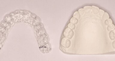 El protocolo clínico del CA Clear-Aligner