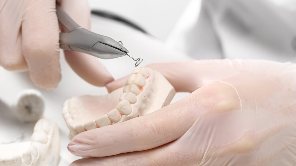 Protesi dentali: la tua ce l’ha il “passaporto”? I consigli di AIOP per tutelarsi da quelle fasulle