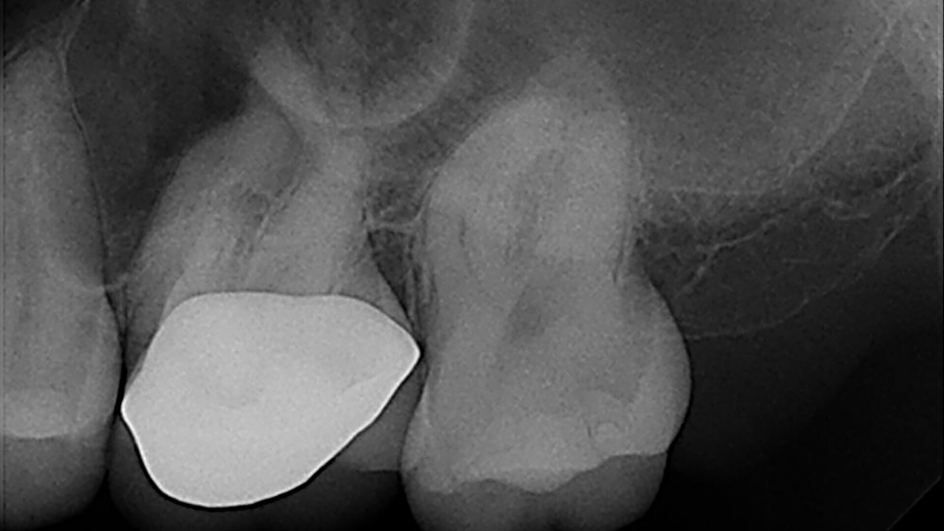 EdgeFile X7: Beastly bifurcation