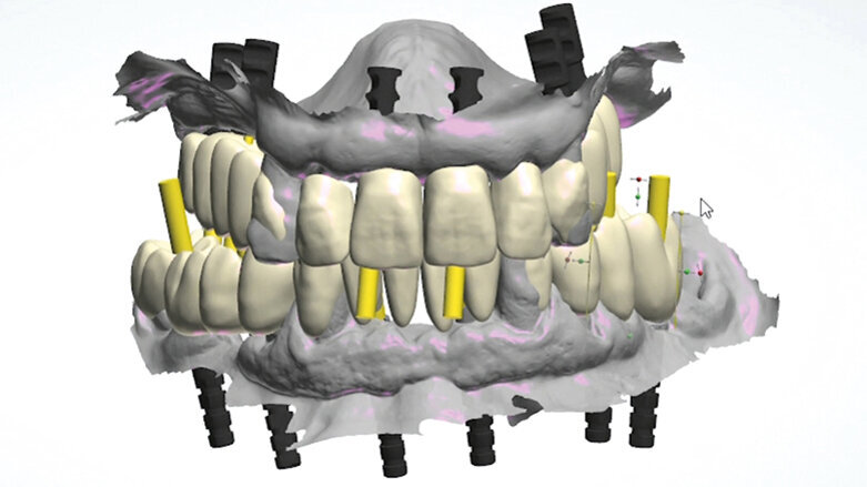 Plně digitální Pro Arch protokol