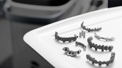 Primescan e sovrastrutture Atlantis: un flusso di lavoro certificato nel trattamento dei pazienti edentuli