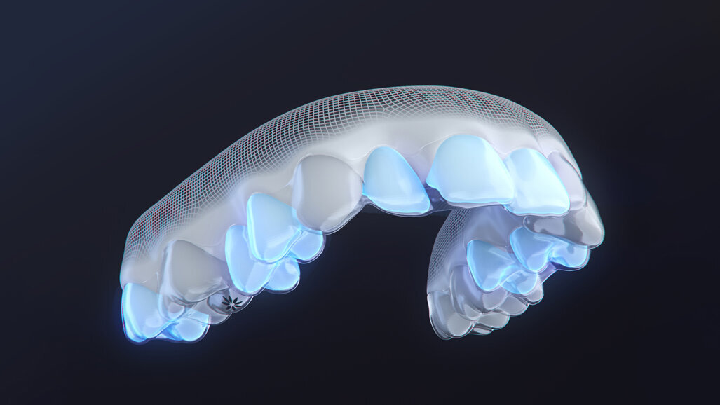 Align Technology introduces invisalign moderate package in the Middle East market