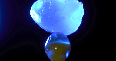 Dientes supernumerarios