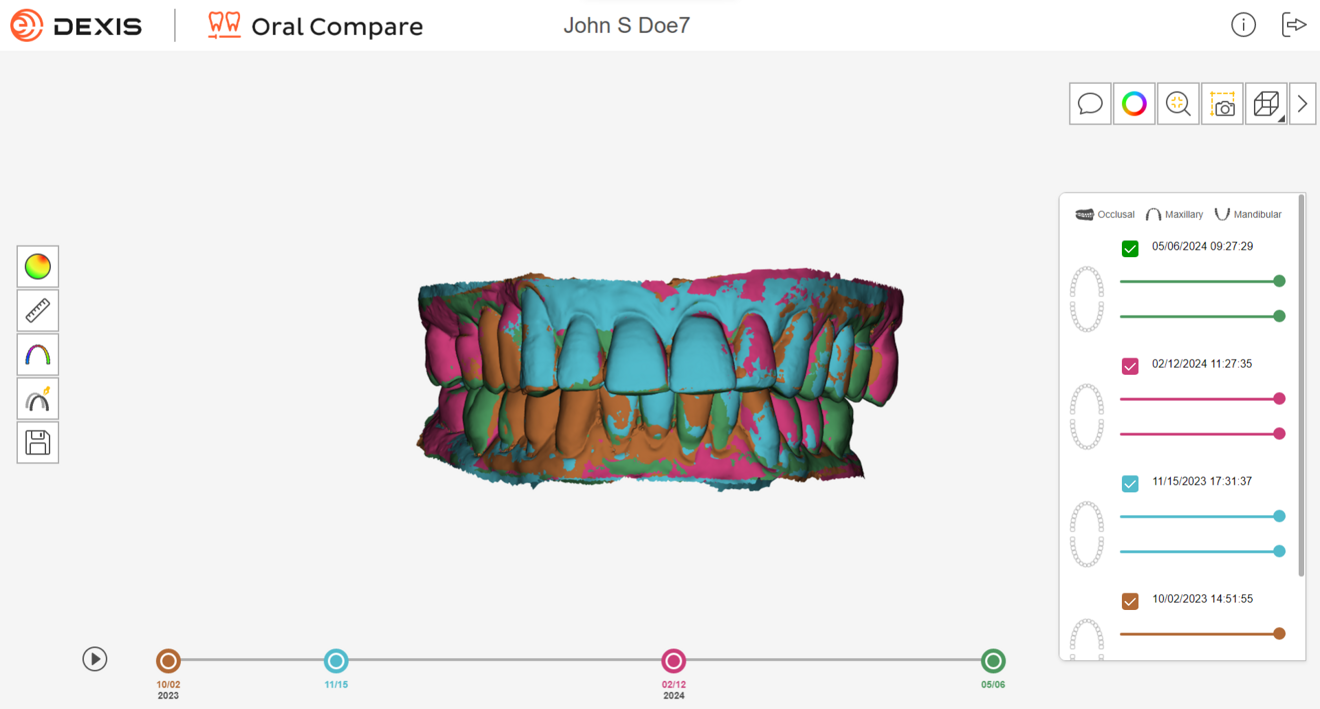 Całkiem nowe narzędzie Oral Compare w oprogramowaniu DEXIS IS ScanFlow.