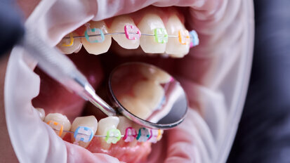 SPÖ-Bundesländer blockieren Neuregelung der Kieferorthopädie