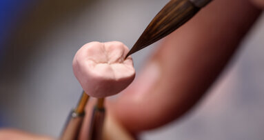 Researchers use generative artificial intelligence to design realistic dental crowns