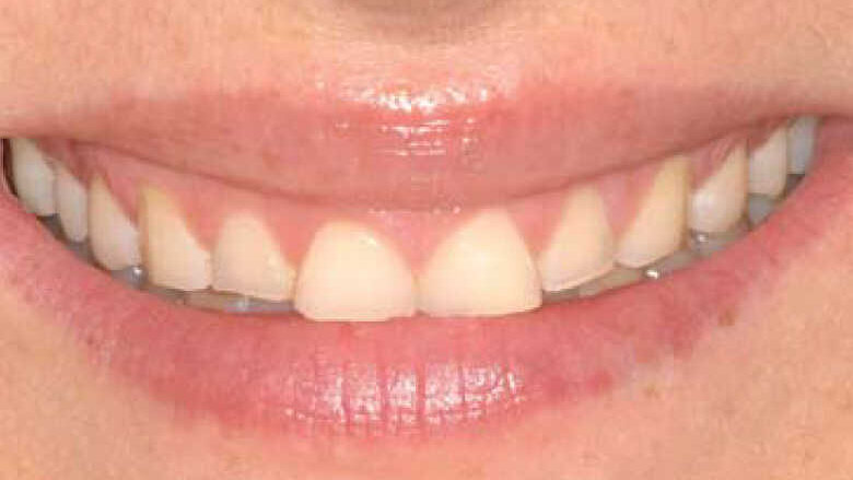 Invasivité minimale – Efficacité maximale