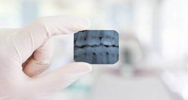 ANVS factsheet over veilig werken met straling