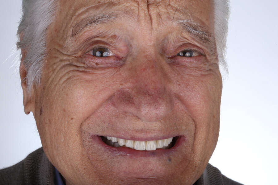 Fig. 21: One-year follow-up, facial view.