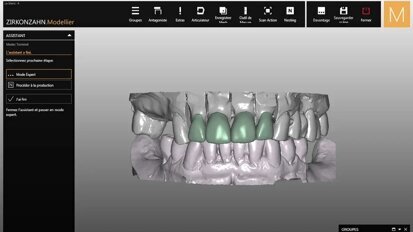 En busca de la sonrisa perdida (2)