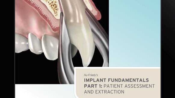 Hu-Friedy releases guide to implantology