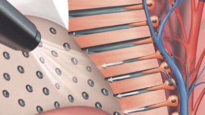 Estética y blanqueamiento dental en la era digital  (Capítulo 11)