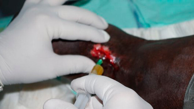 Emocomponenti in Africa grazie alle missioni umanitarie