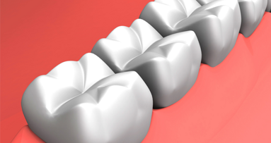 Erfolgreich: 3-D-gedrucktes Gerüst zur Weichgeweberegeneration