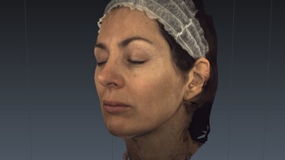 Utilizzo della scansione facciale per lo studio delle rughe del viso