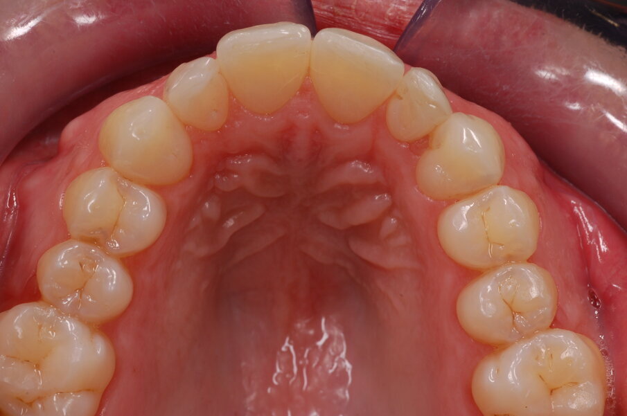 Figg. 51-58_Fotografie facciali e intraorali post-trattamento.