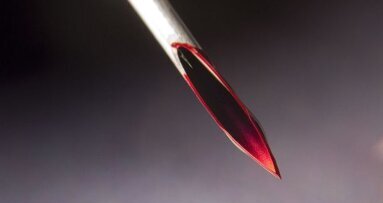 Onveranderd veel prikaccidenten in mondzorg