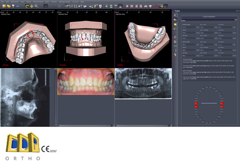 Polorto – DDP-Ortho Software