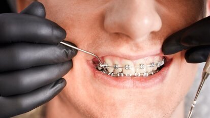 Prawidłowy zgryz to warunek utrzymania równowagi funkcjonalnej całego organizmu