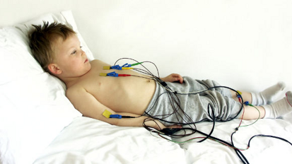 Estudo descobre número alto de cáries em crianças com doenças cardíacas