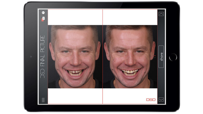 Kdo potřebuje Digital Smile Design (DSD)?