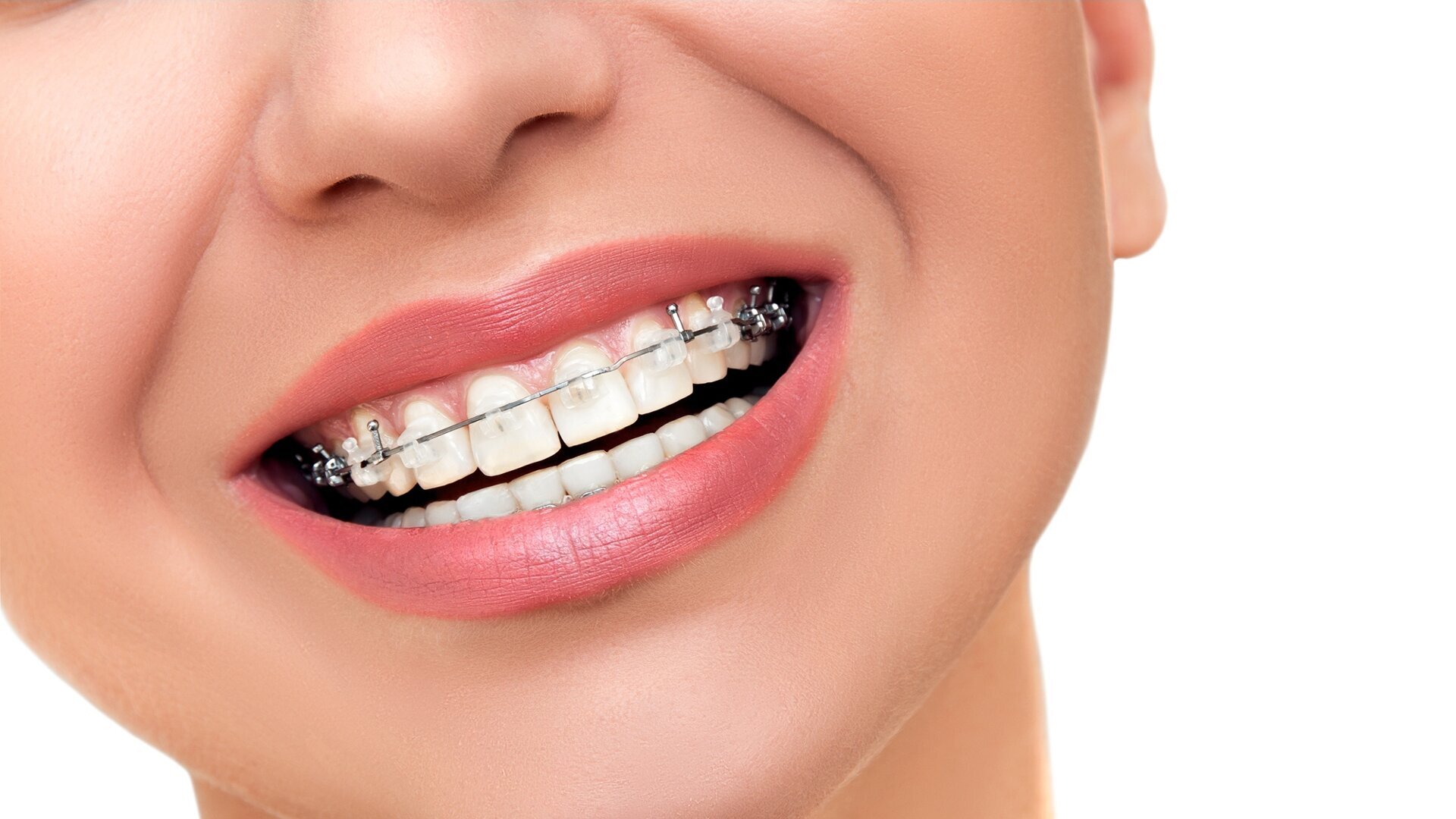 Orthodontics: Short-term gains … long-term problems?