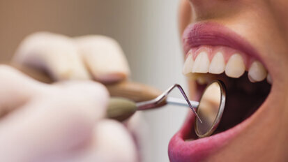 En verano, el aumento de bacterias patógenas en la boca puede provocar problemas bucodentales