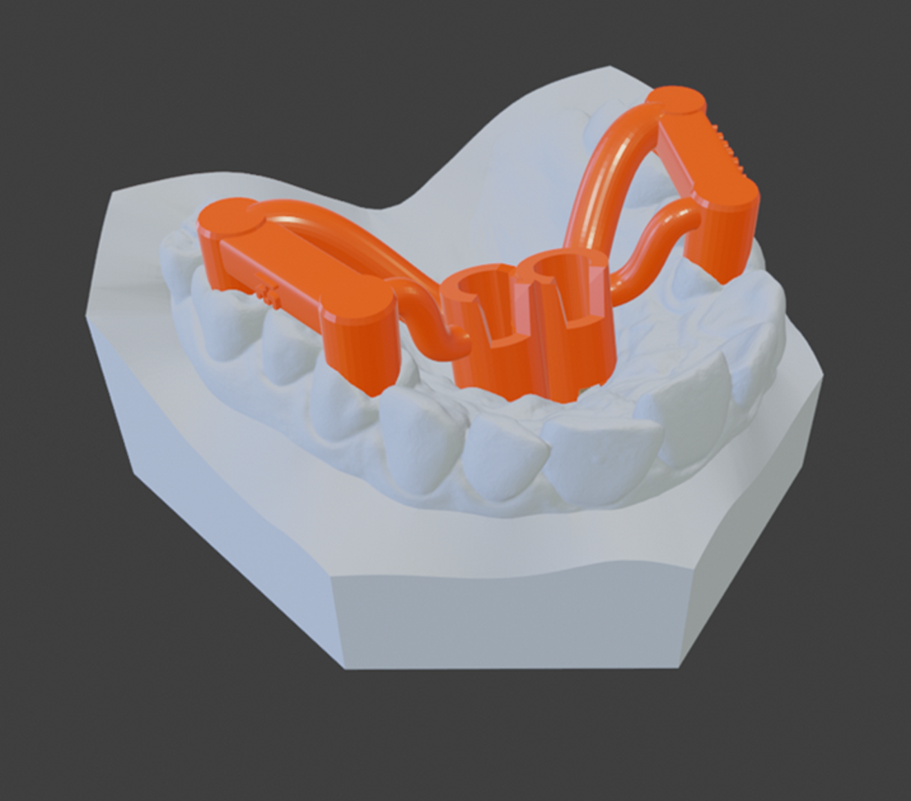 Fig. 5: Insertion guide.