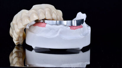 Utilizzo della stampante 3D in un flusso di lavoro totalmente digitale