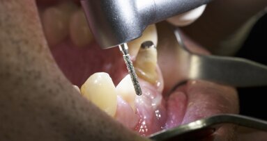 It is all about control