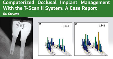 Computerized Occlusal Implant Management With the T-Scan II System: A Case Report