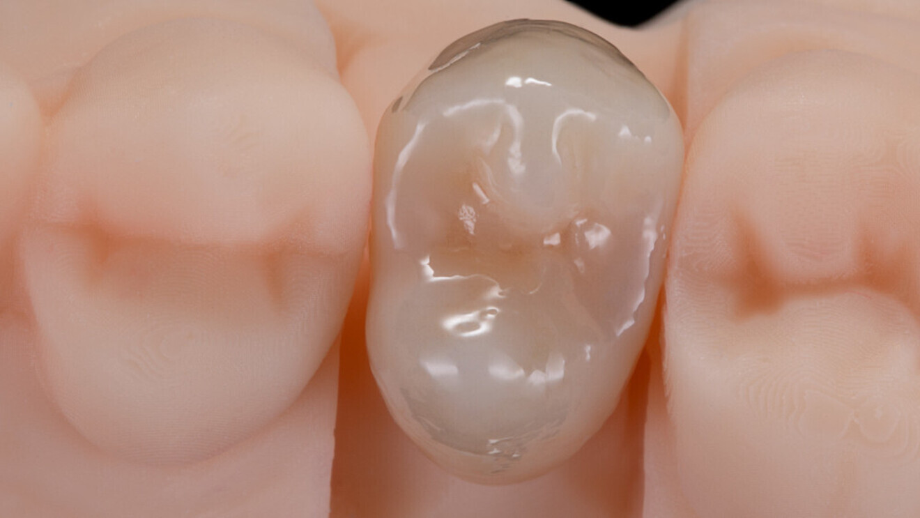 Fig. 16: Harmonious naturalness and a radiantly warm liveliness from the inside out, achieved in a very short production time.