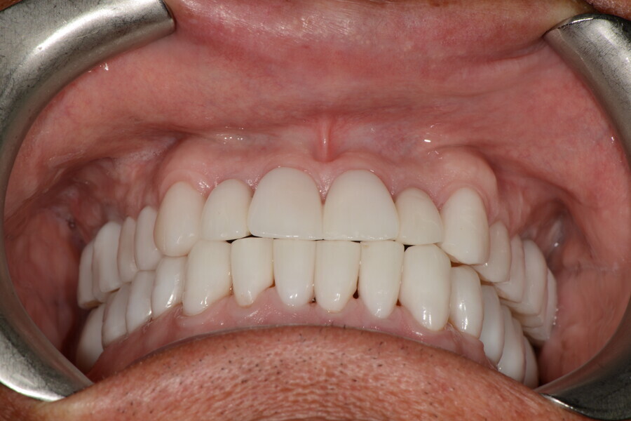 Fig. 32h: Inferior view.