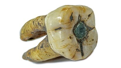 Las asombrosas decoraciones dentales de la antigüedad