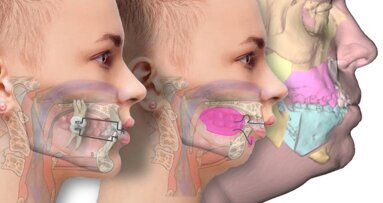 El enorme impacto de la Ortodoncia Médica