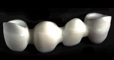 Houska-Preis für TU Wien