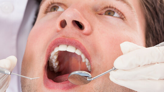 Erhebung: So sieht es im Mund der Schweizer aus