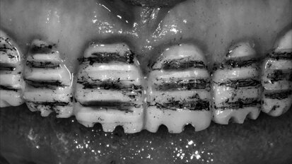 Interdisciplinární přístup v estetické stomatologii