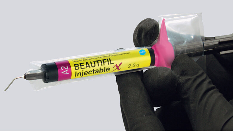 Inject and shape for easier, faster, stronger restorations