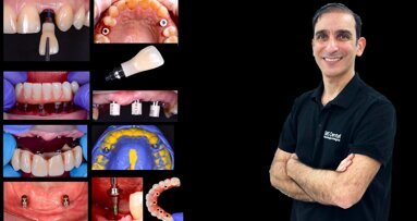 Cursos de Rehabilitación Oral, Prótesis sobre Implantes y Carillas con Ariel Labanca