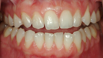 Occlusion principles for the practising dentist in the digital age