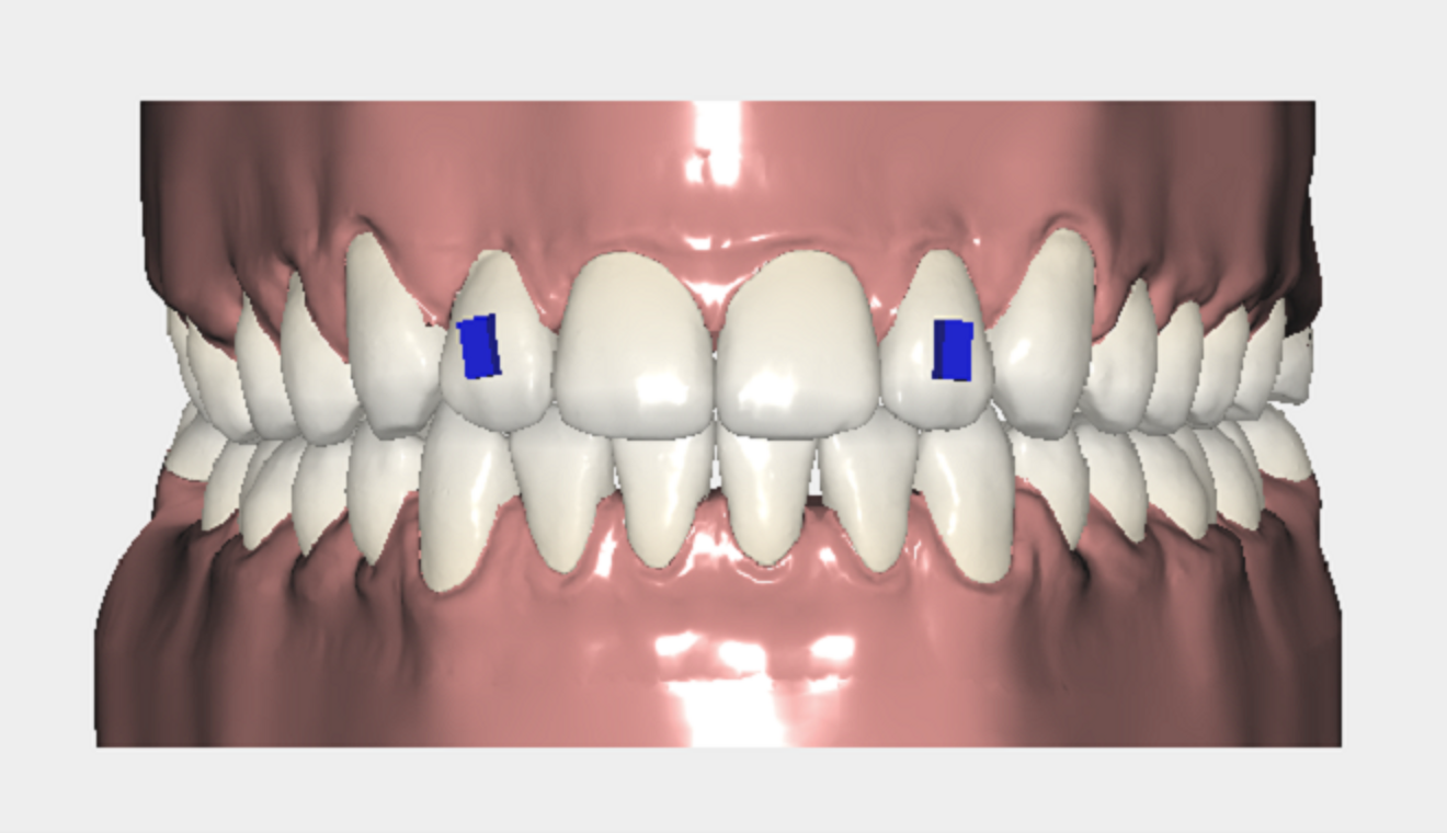 Fig. 6: Studio Pro 4.0 model with new attachments.