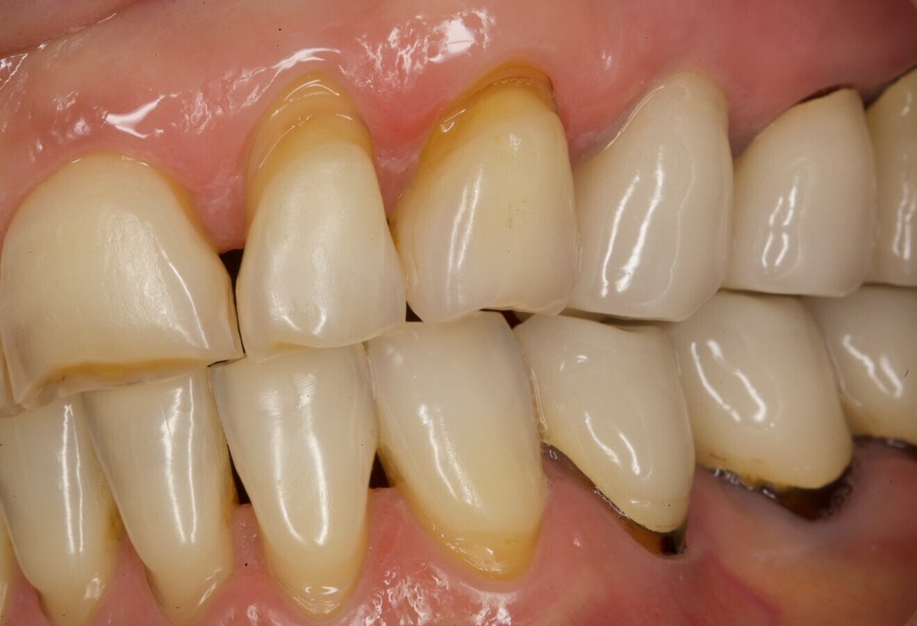 Fig. 1b: Lateral view from the left. 