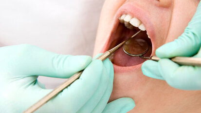 Parodontitis – wie steht es damit in Österreich?