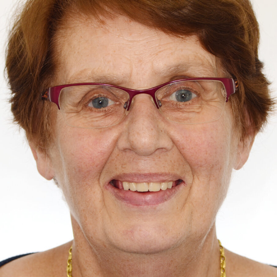 Figs: 3: The anterior setup was tried in and the phonetic and aesthetic details adjusted as required.