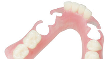 Nobilium: History of flexible partials