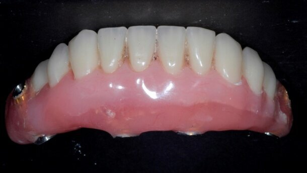 Estetyczna i funkcjonalna rehabilitacja