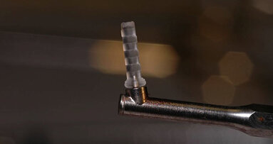 Using SonicPin Rx: Dissolving the need for metal fixation screws in implant site development