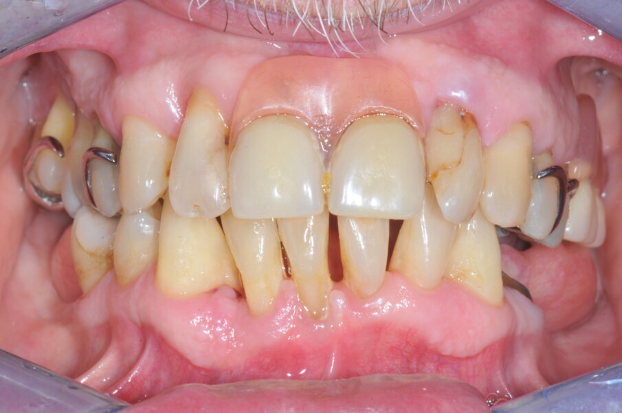 Fig. 1a_Situazione clinica iniziale.