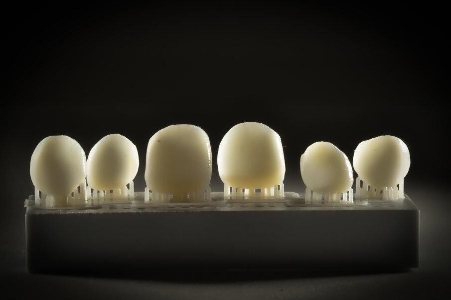 Fig. 15 - Le faccette stampate con tecnologia PHOTOSHADE.